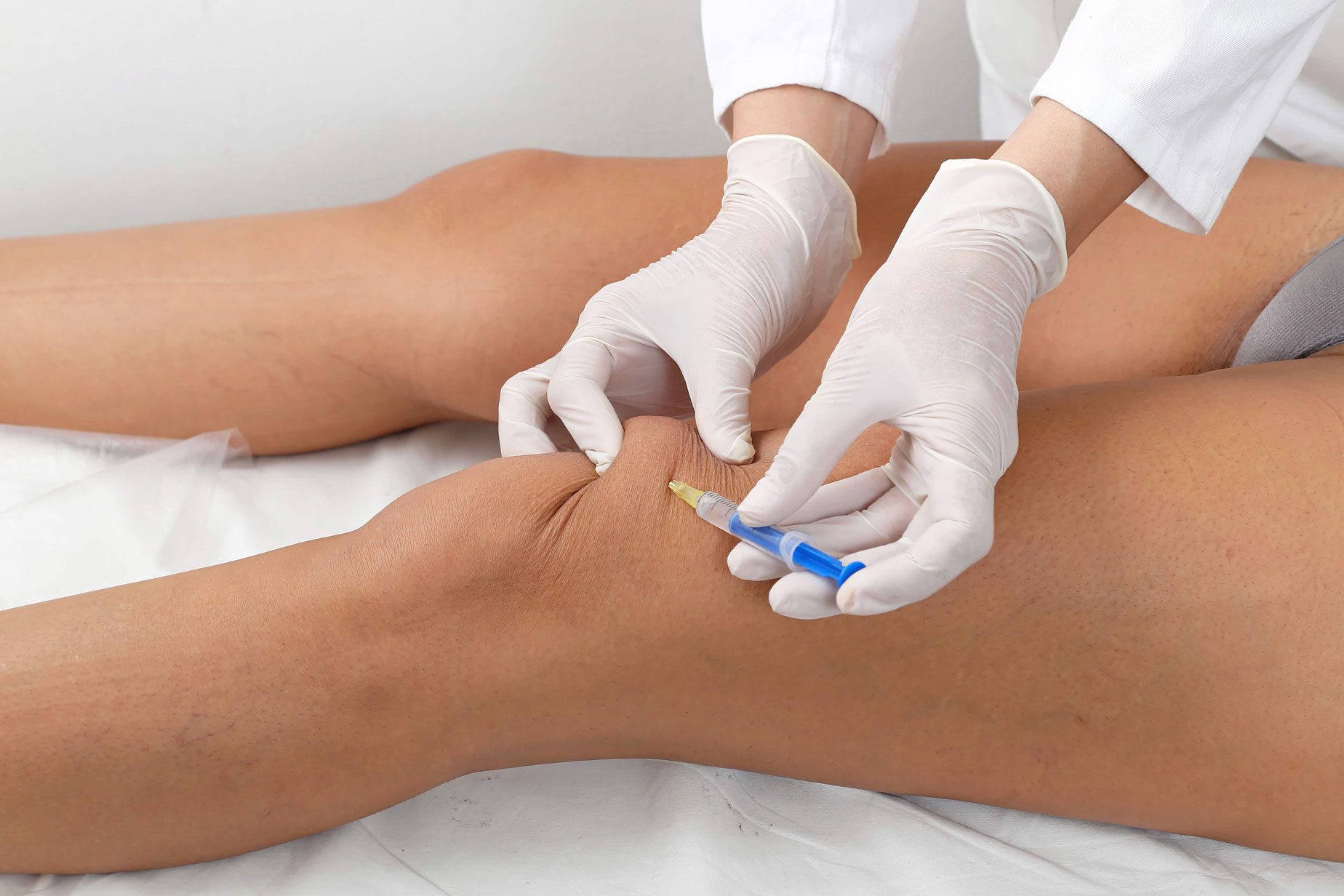 How to Treat Arthritis in Knees Without Surgery