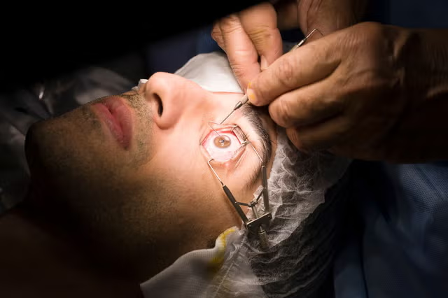 What Are the Risks of LASIK Eye Surgery
