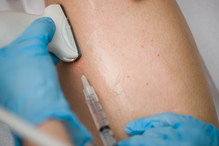 A Closer Look at Chronic Venous Insufficiency and Its Management