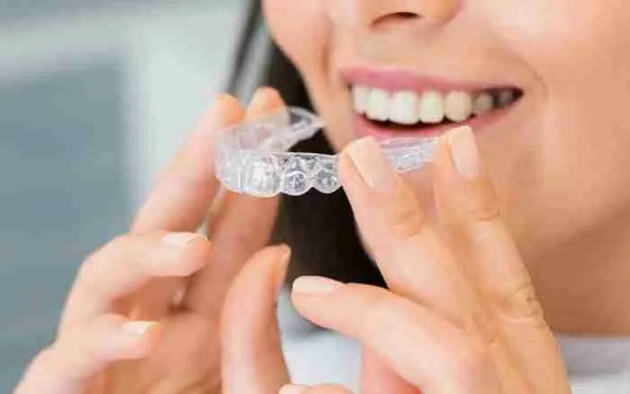 How To Maintain Clear Aligners Throughout Your Treatment Period
