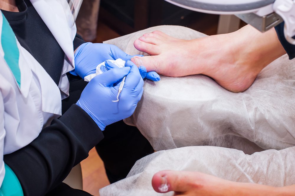 Nail Care Tips for Preventing Ingrown Toenails
