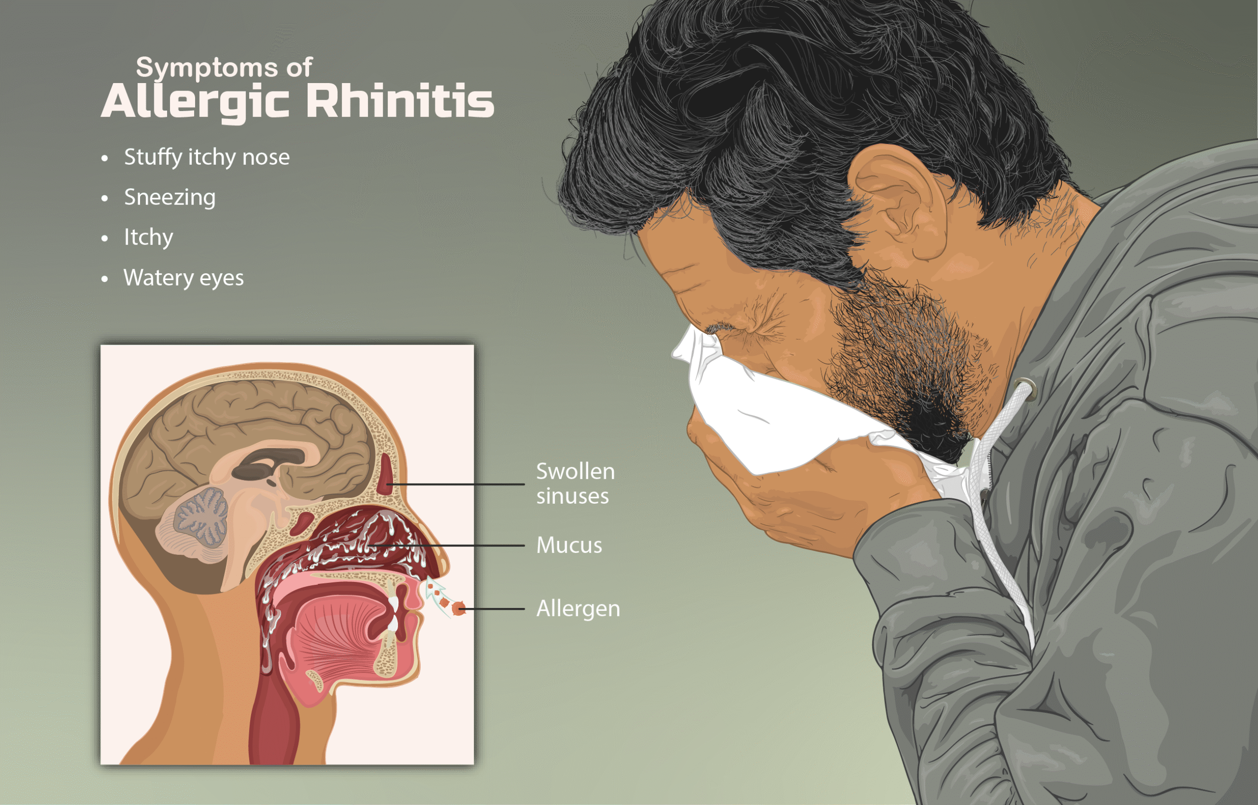 The Relationship Between Immunologists and Allergic Rhinitis