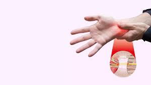 Understanding Hand Surgery and the Recovery Process