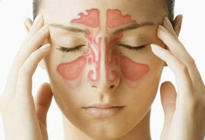 Understanding the Differences Between Acute and Chronic Sinusitis