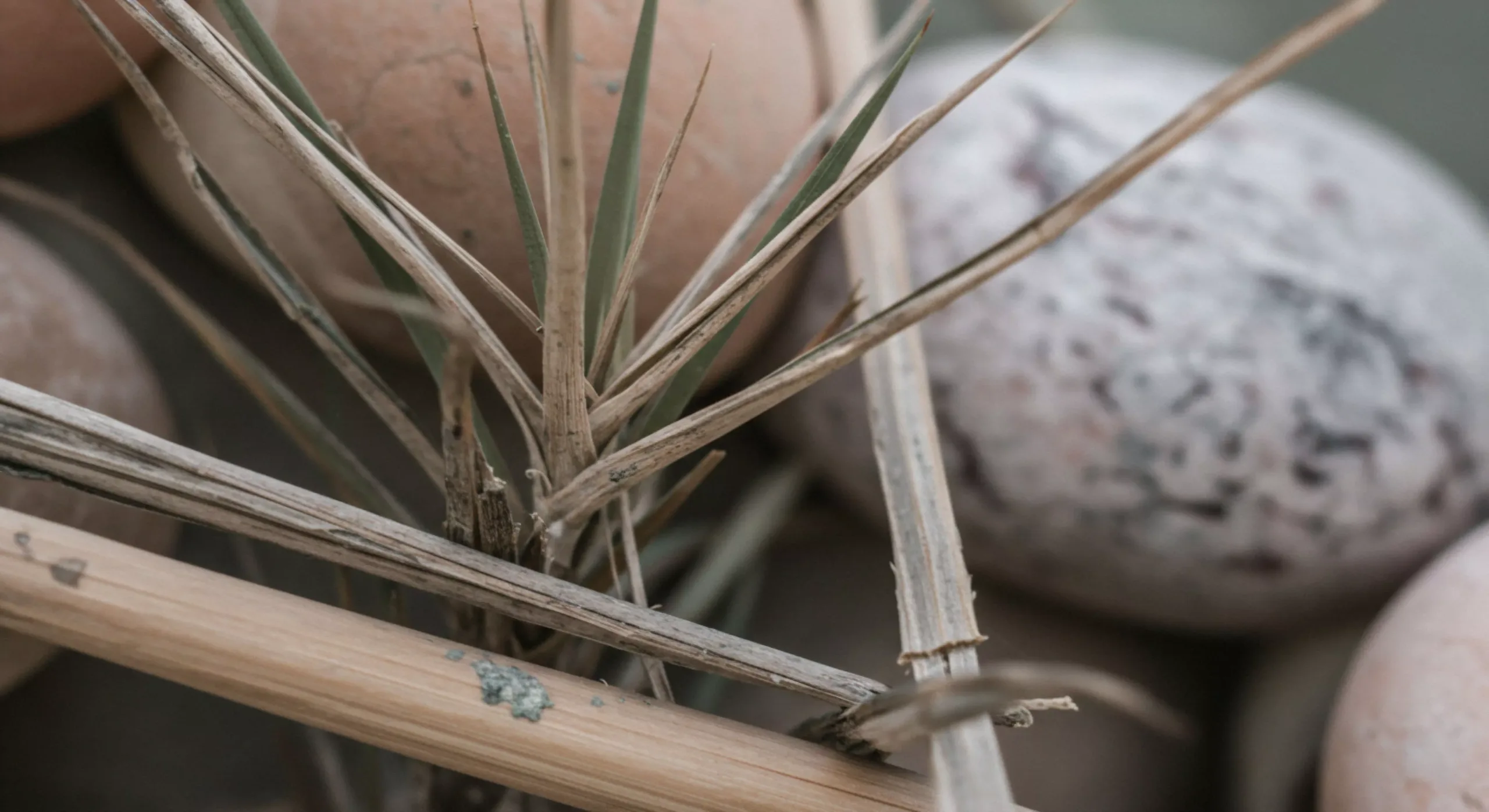 Exploring the Different Types of Kidney Stones and Their Causes