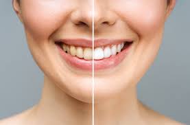 How Cosmetic Dentistry Can Enhance Your Smile