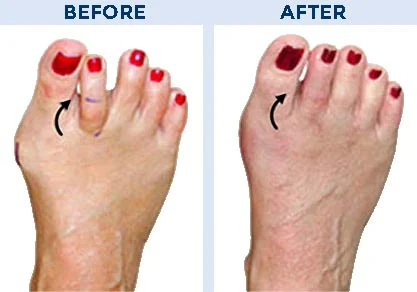 What To Expect Before and After a Podiatry Surgical Procedure What To Expect Before and After a Podiatry Surgical Procedure