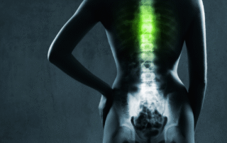 The Impact of Lower Back Pain on Health