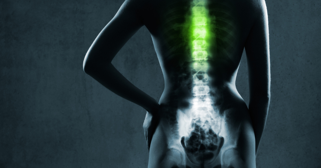 The Impact of Lower Back Pain on Health